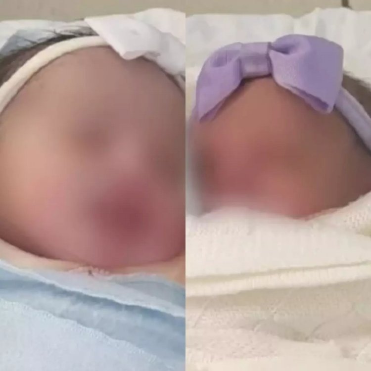 Mulher dá à luz a gêmeas durante 'dor de barriga' e uma das bebês cai na privada